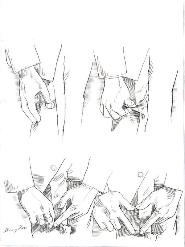Coin Through Leg I - Page 144 - Left Page